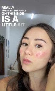 Cheek blush tattoo 14 hours after — right cheek