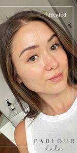 Cheek blush tattoo at day 7 — healed into a soft rosy glow