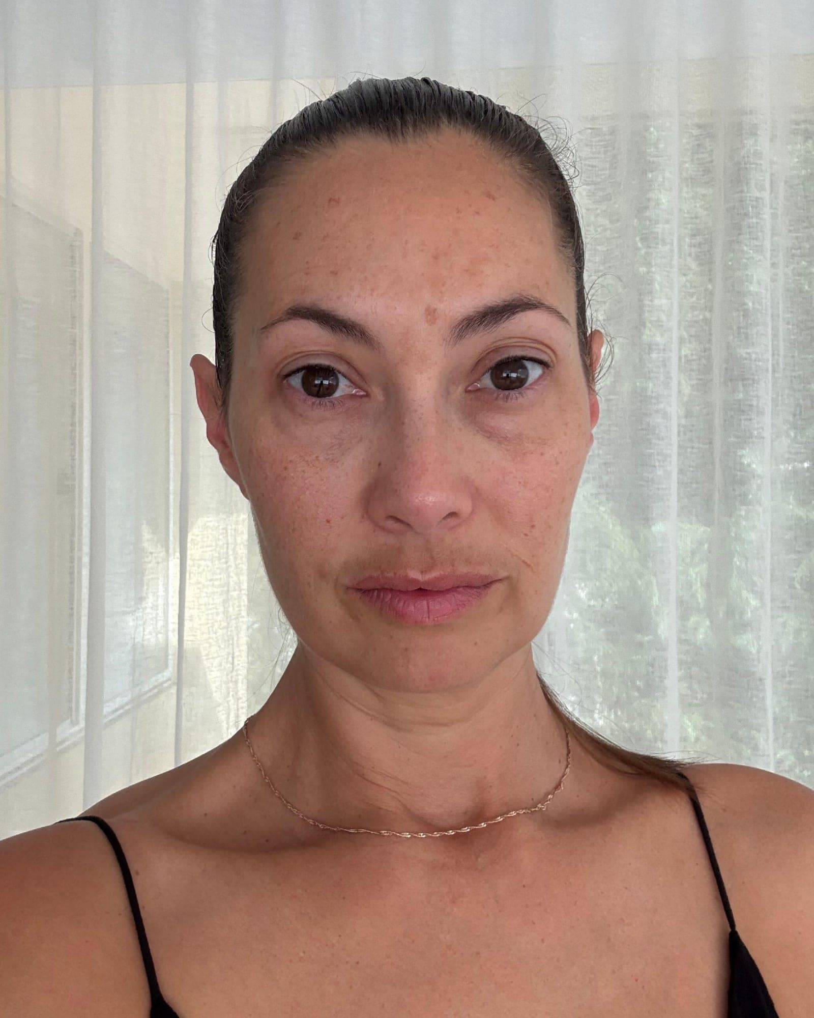 Samantha's neck and décolletage before using Système Bio+ Oil Serum
