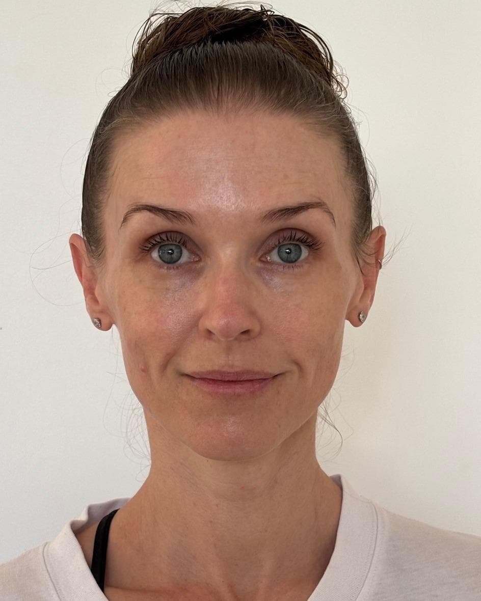 Sheryn's skin after the trial showing improved glow and hydration