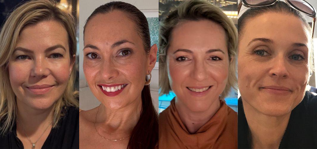 Système Bio+ Oil Serum before and after skin results