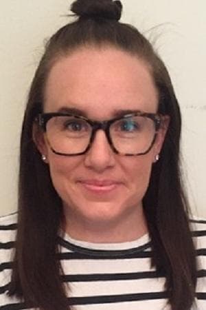 Amy's skin after eight weeks — improved texture and reduced pigmentation