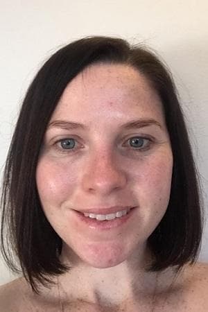 Kahli's skin after eight weeks — smoother fine lines around the eyes