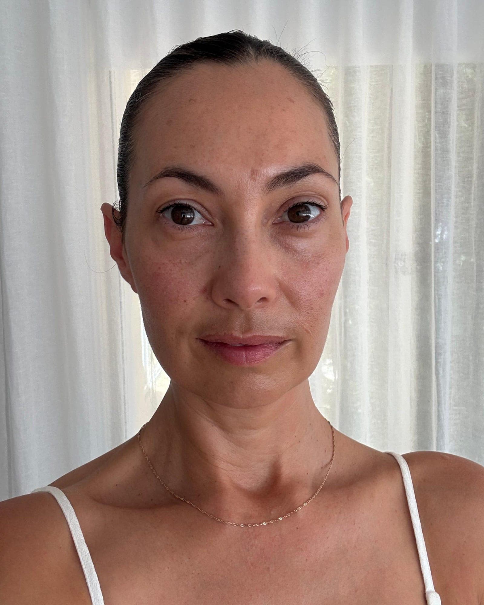 Samantha's neck and décolletage after the trial showing improved suppleness