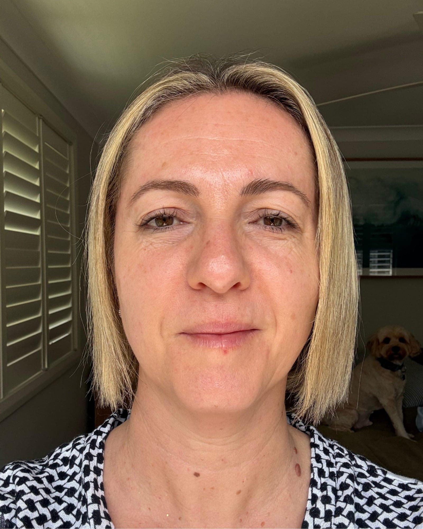 Katelyn's skin after the trial showing improved hydration