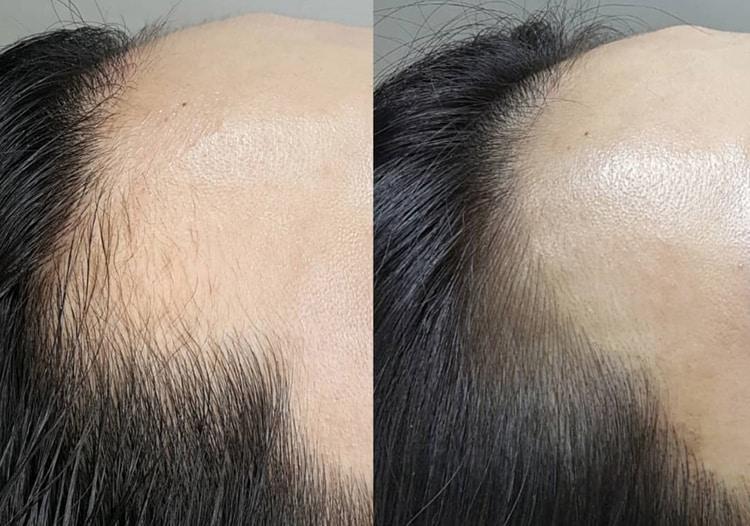 Before & After. Image: Instagram @OllaLine