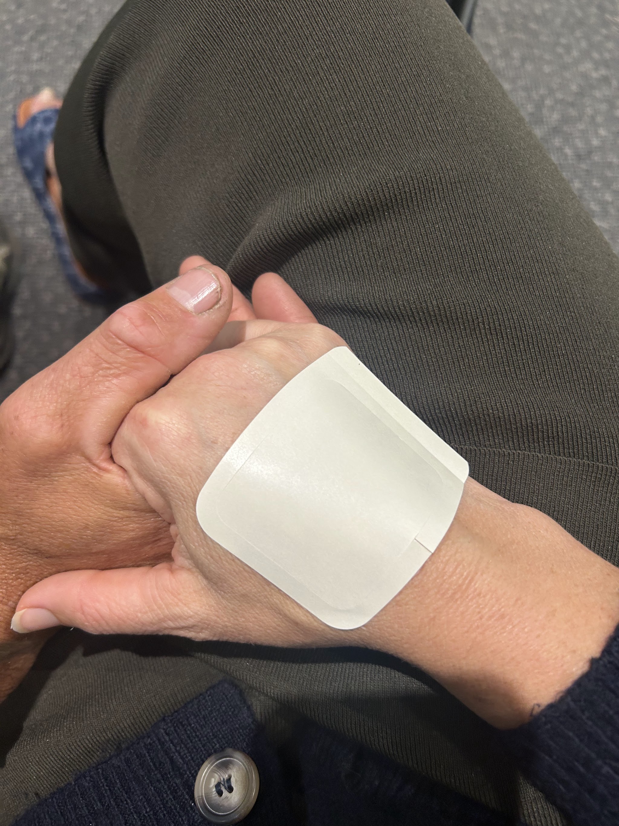 Colette's hand bandaged after treatment, showing the reality of what each session involves